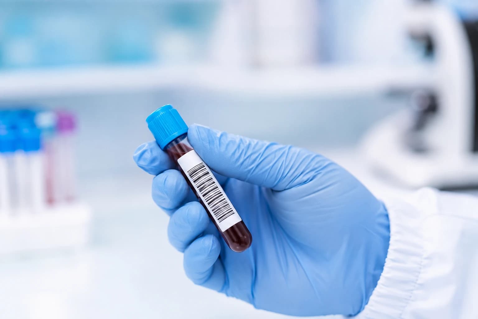 A gloved hand holding a blood sample vial for a vitamin D blood test