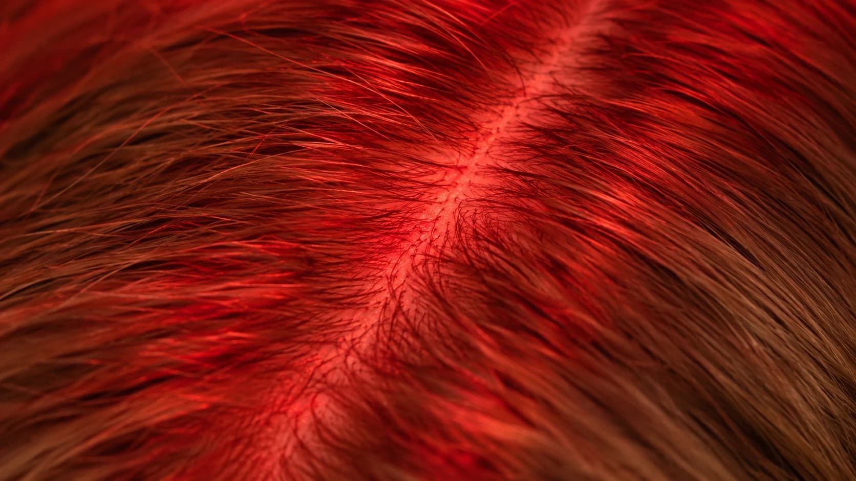 Close-up of red therapy light reaching the scalp through parted hair